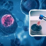 Terapia komórkami macierzystymi: pierwszy kraj na świecie, który zezwolił na